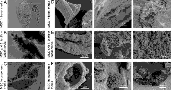 科學家用生物3D打印技術為干細胞工程提供細菌負載微凝膠