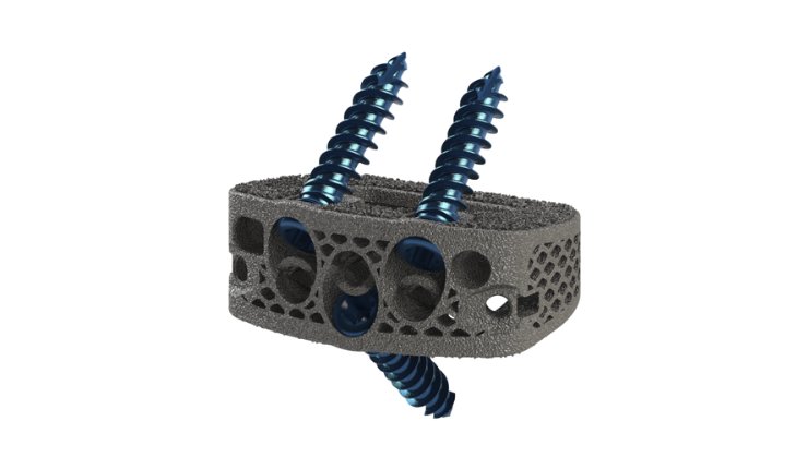 DeGen Medical 3Dӡ׵gںи߿ҕԺ͙Cе